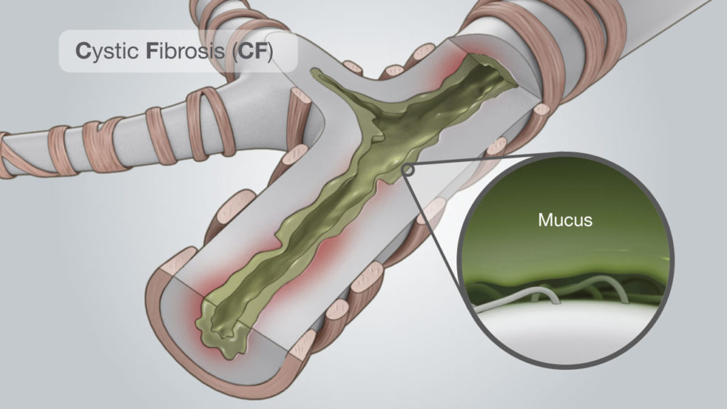 Kalydeco Cystic Fibrosis Animation | AXS Studio