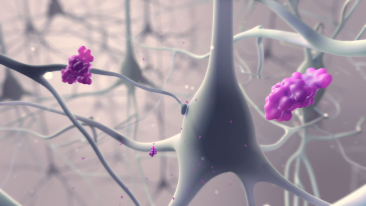axs-studio-transdermal-opioid-analgesic-mechanism-of-action-moa-animation-01