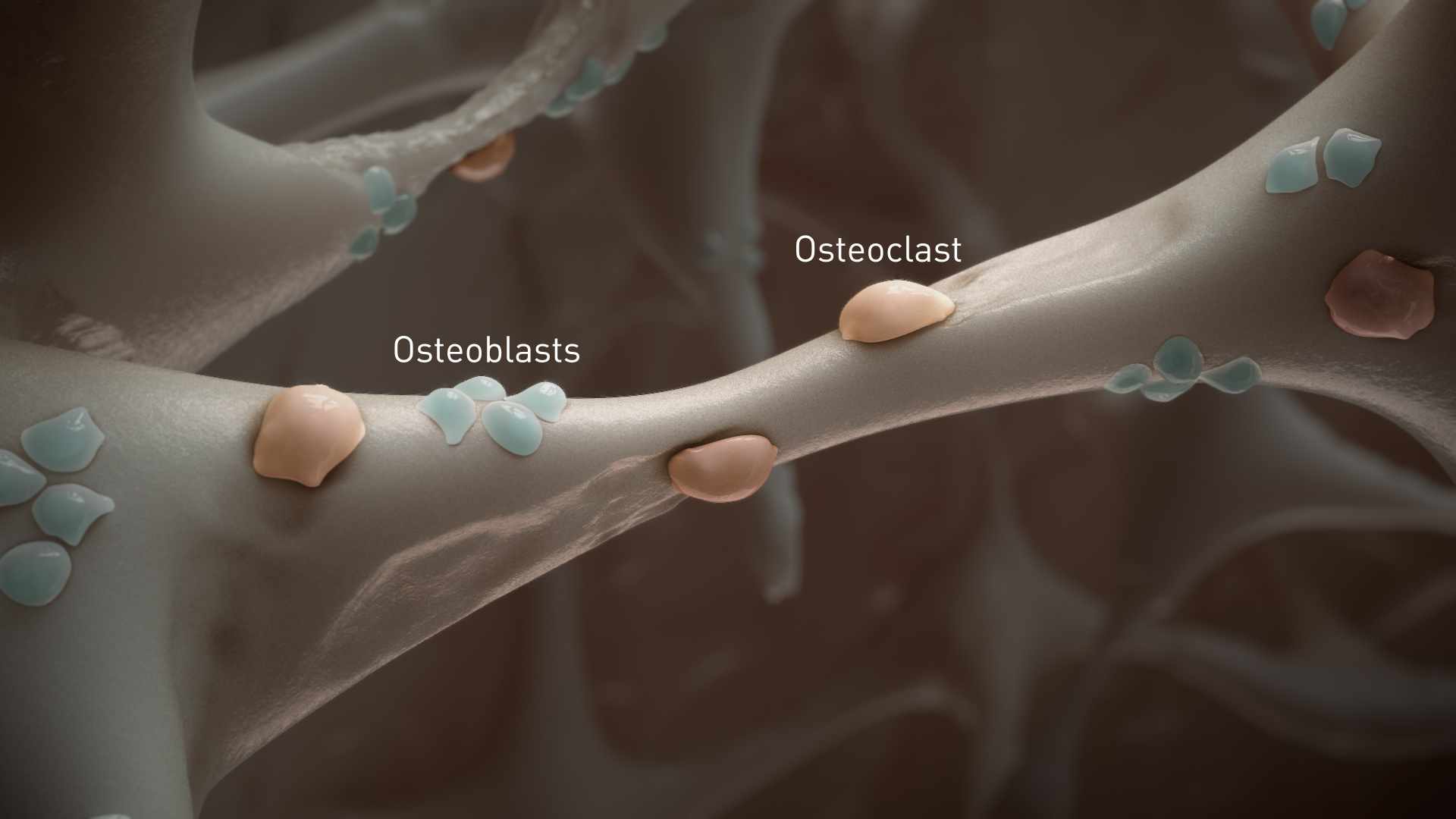 Osteoporosis Mechanism of Disease Animation | Medical Animation