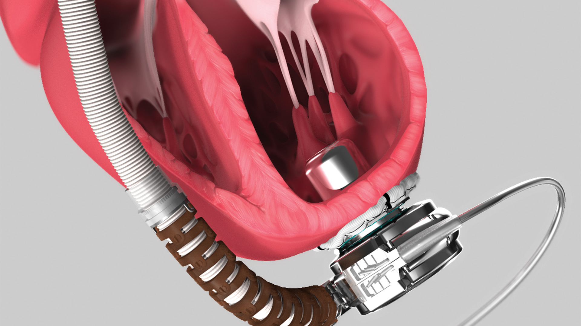 vad-medical-device-animation-axs-studio