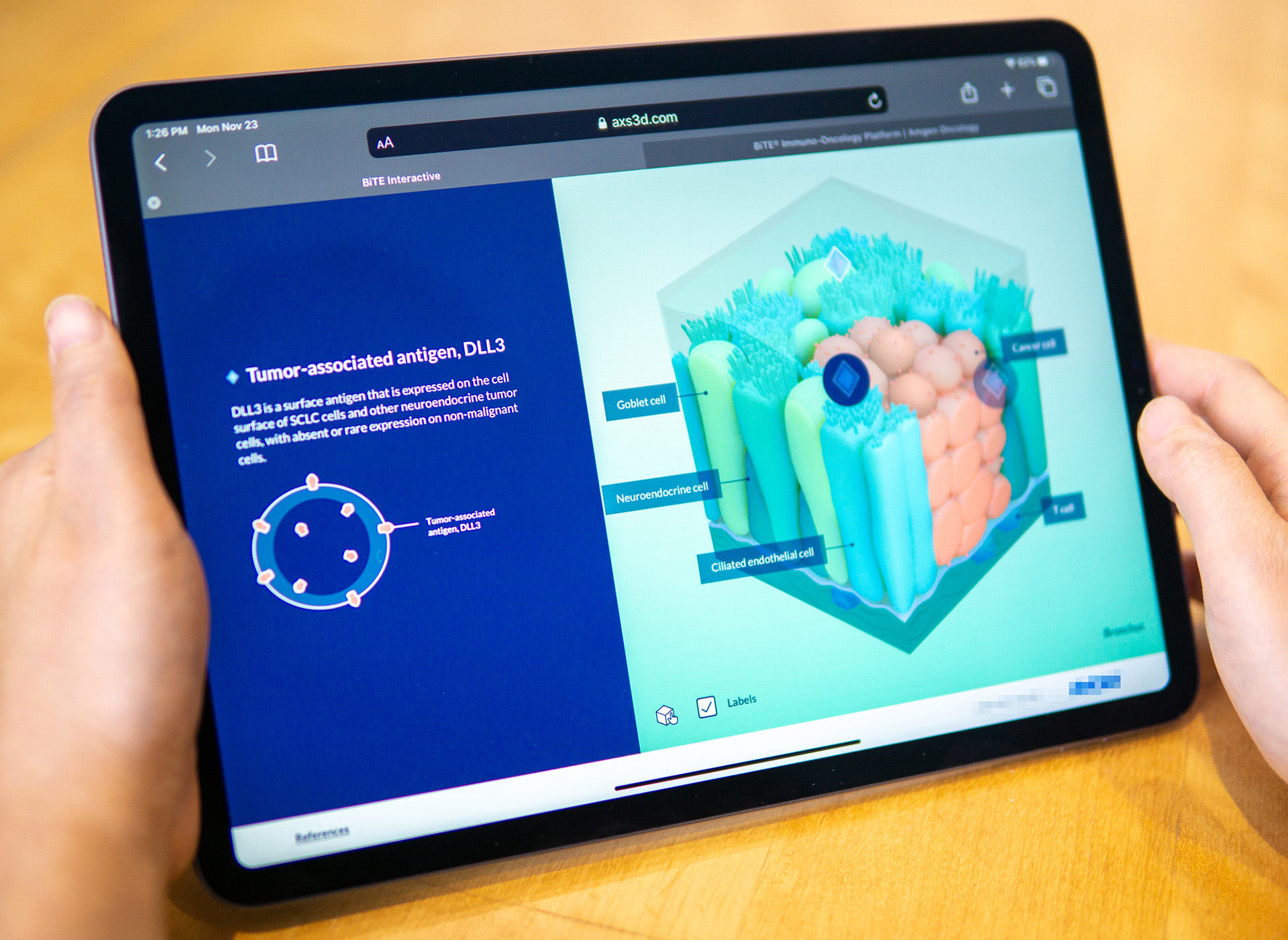 axs-studio-virtual-exhibit-oncology-interactive-05-drv-clean