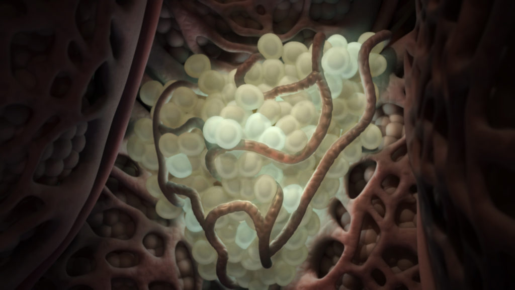 axs-studio-medical-animation-liver-fibrosis-and-cancer-angiogenesis