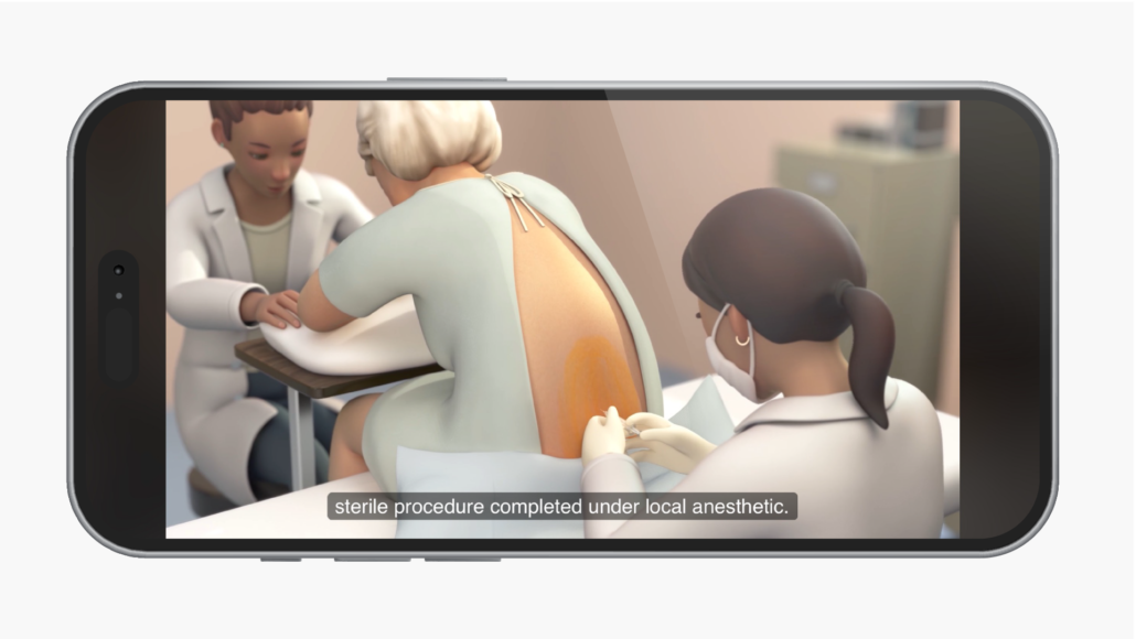 Medical animation still image on a smart phone with open captions turned on. © 2024 AXS Studio. All rights reserved.