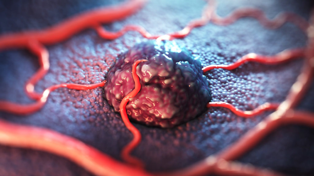 Still image from the Certepetide MOA animation showing a solid tumor growing. 