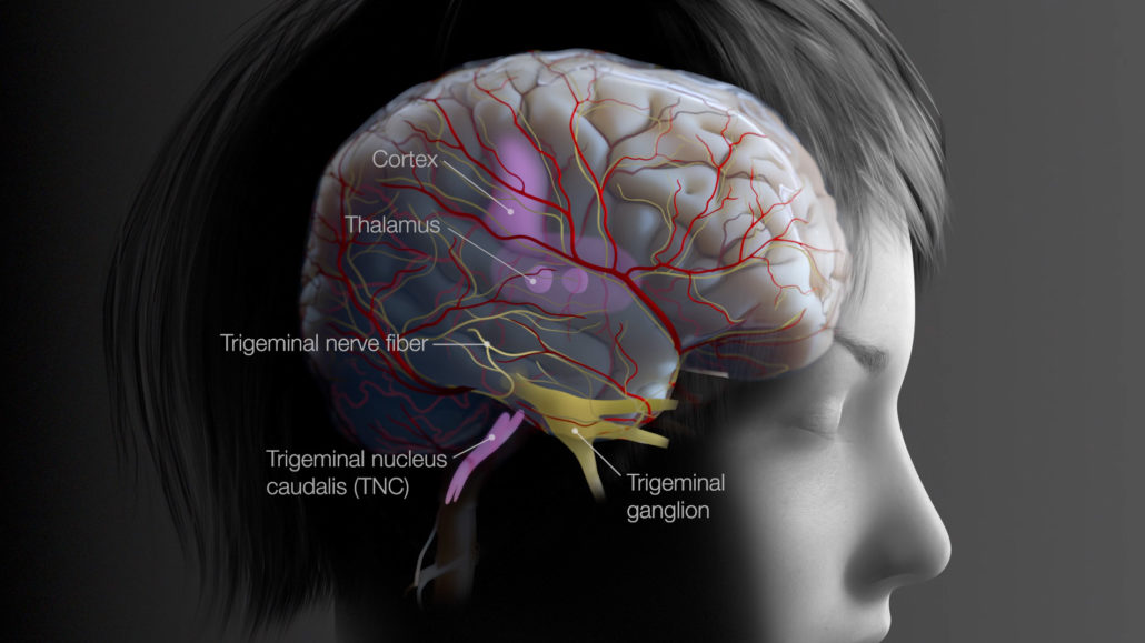 Profile view of a female migraine patient with brain anatomy overlayed, defining the cortex, thalamus, trigeminal nerve fibers, trigeminal nucleus caudalis (TNC) and trigeminal ganglion.
