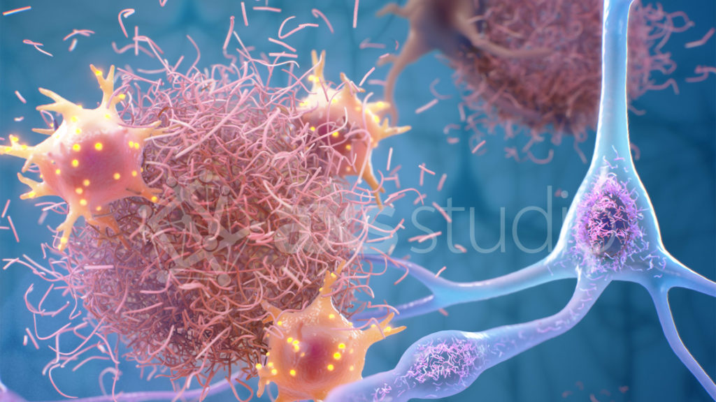 Detail from a medical illustration for Scientific American article