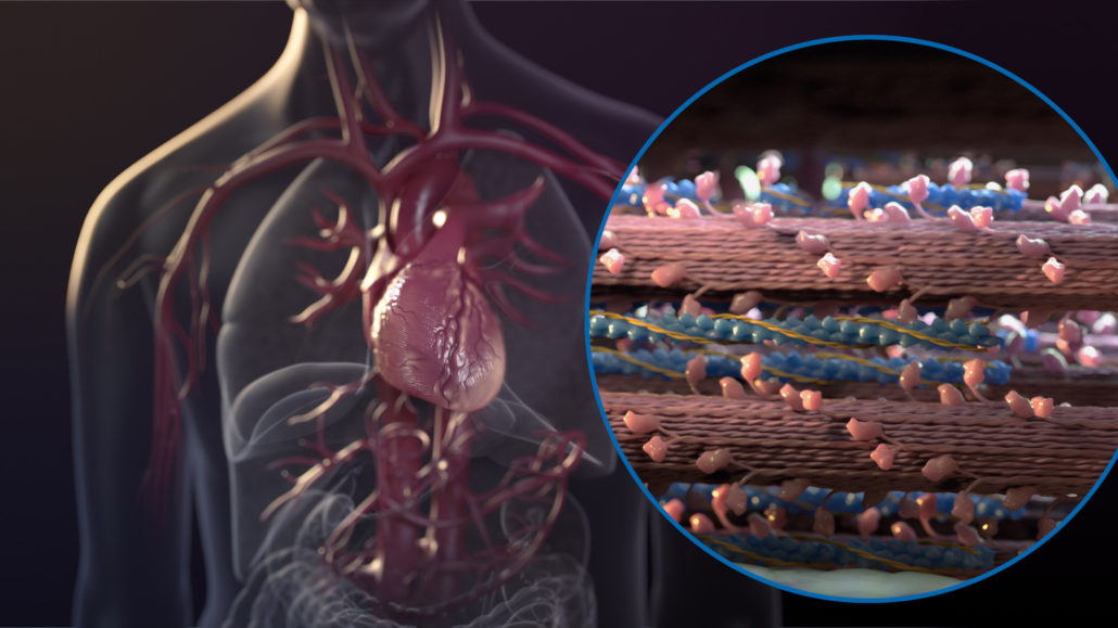 The role of contractility in cardiac function; 3D medical animation; MOD; Male torso showing heart, great vessels and lungs; callout showing sarcomeres with actin and myosin; ACC American College of Cardiology (cancelled due to COVID-19); online use on heartfailurelink.com