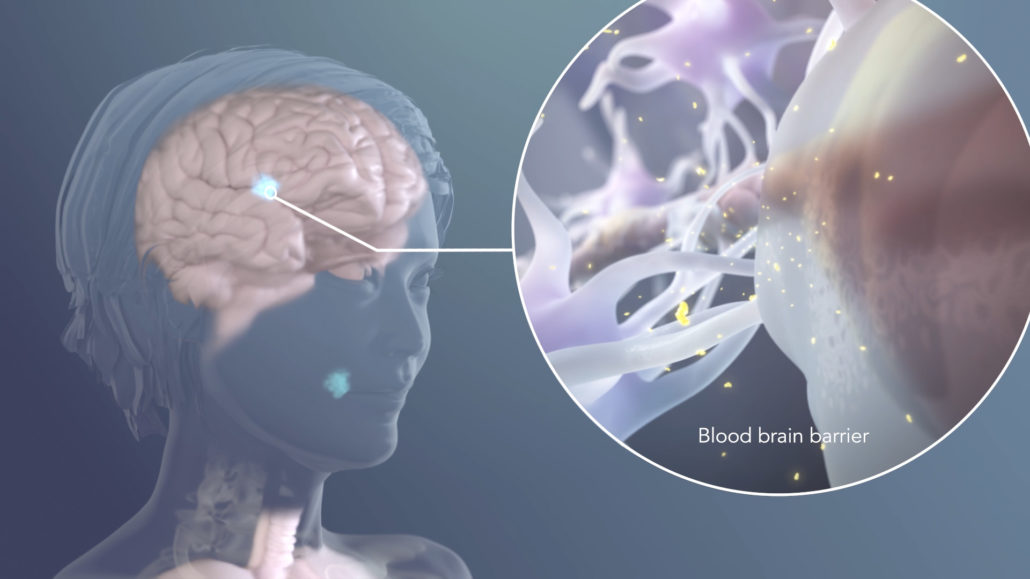 A translucent female patient (head and shoulders) with her brain visible. A callout circle shows a magnification of a brain capillary. Astrocyte end feet form a translucent membrane around the capillary. Small yellow drug molecules diffuse from the capillary into the interstitial fluid.